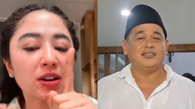 Dewi Perssik dan Ketua RT Berdamai Usai Ribut soal Sapi Kurban